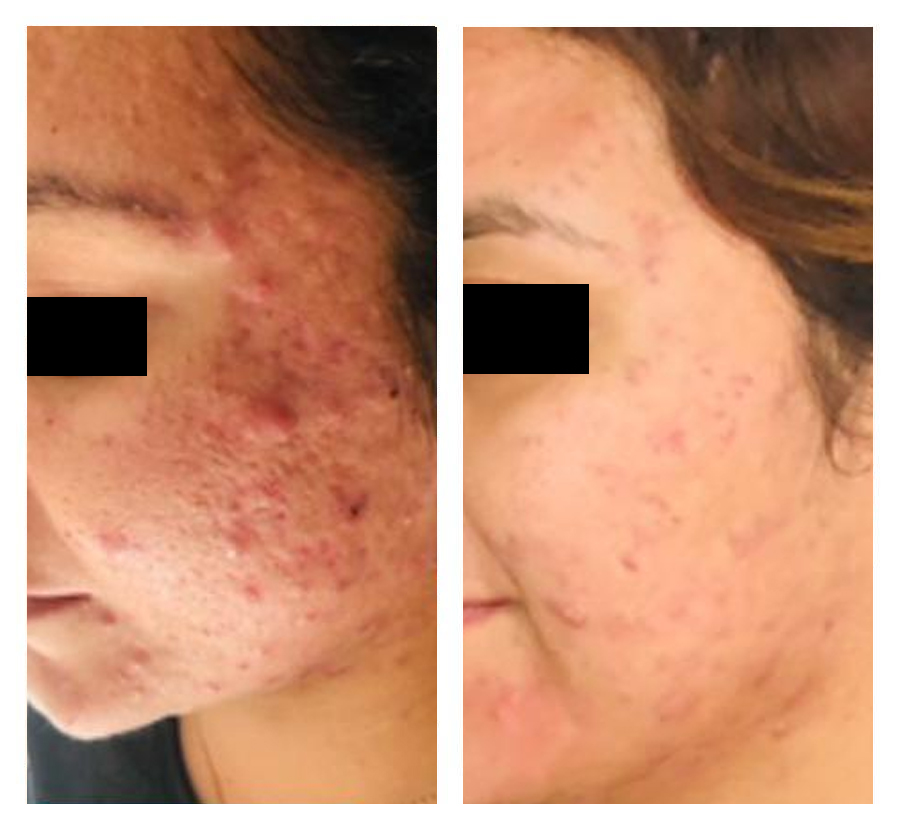 Free HTML5 Bootstrap Template